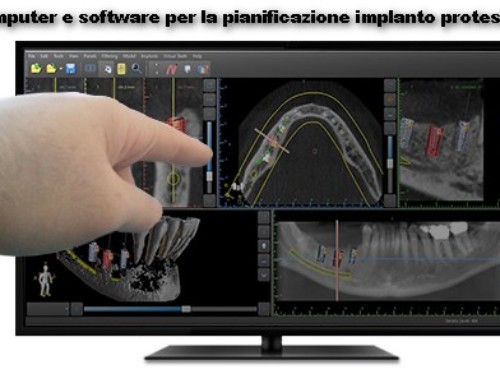 Impronta digitale