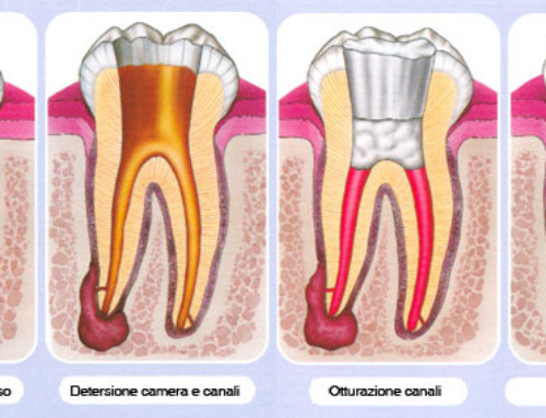 Endodonzia