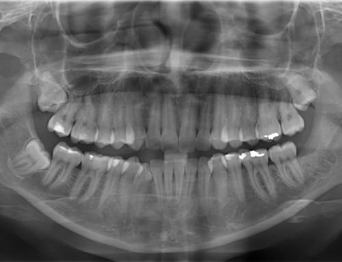 Radiologia Odontoiatrica Digitale